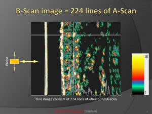 b-scan-image-224-lines-of-a-scan-n